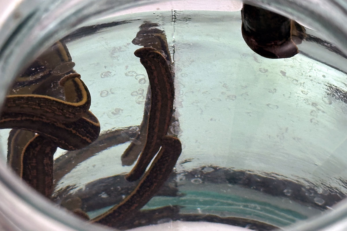 Гирудотерапия